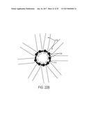 ARTICULATED COMMISSURE VALVE STENTS AND METHODS diagram and image