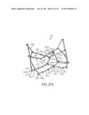 ARTICULATED COMMISSURE VALVE STENTS AND METHODS diagram and image