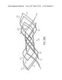 ARTICULATED COMMISSURE VALVE STENTS AND METHODS diagram and image