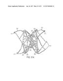 ARTICULATED COMMISSURE VALVE STENTS AND METHODS diagram and image