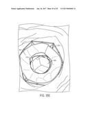 ARTICULATED COMMISSURE VALVE STENTS AND METHODS diagram and image