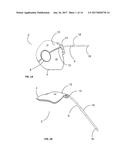 OCULAR DRAINAGE DEVICE AND METHOD OF MANUFACTURING THEREOF diagram and image