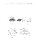 OCULAR DRAINAGE DEVICE AND METHOD OF MANUFACTURING THEREOF diagram and image