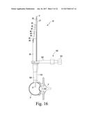 DIRECTIONAL SEQUENTIAL DILATION SYSTEM WITH NEURO MONITORING diagram and image