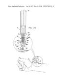 SAFETY DRUG HANDLING DEVICE diagram and image