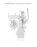 SAFETY DRUG HANDLING DEVICE diagram and image