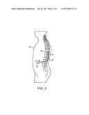 SPATIALLY SELECTIVE NERVE STIMULATION IN HIGH-FREQUENCY NERVE CONDUCTION     BLOCK AND RECRUITMENT diagram and image