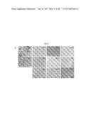 ANTI-A  GLOBULOMER 4D10 ANTIBODIES diagram and image