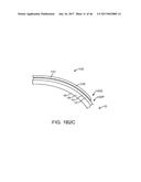 CONFORMABLE THERAPEUTIC SHIELD FOR VISION AND PAIN diagram and image