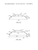 CONFORMABLE THERAPEUTIC SHIELD FOR VISION AND PAIN diagram and image