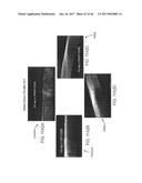 CONFORMABLE THERAPEUTIC SHIELD FOR VISION AND PAIN diagram and image