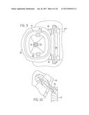 Sterile Implant Tracking Device and Method diagram and image