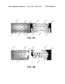 PATIENT-SPECIFIC THREE-DIMENSIONAL DENTITION MODEL diagram and image