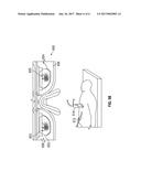 MEDICAL DEVICE APPROACHES diagram and image