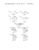 SURGICAL FASTENER diagram and image