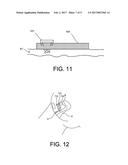 TISSUE ANCHOR WITH INSERTION DEVICE diagram and image