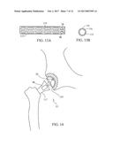 ACOUSTIC THERAPY DEVICE diagram and image