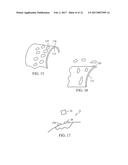 ACOUSTIC THERAPY DEVICE diagram and image