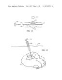 ACOUSTIC THERAPY DEVICE diagram and image