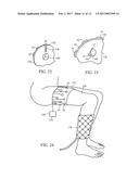 ACOUSTIC THERAPY DEVICE diagram and image