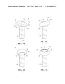 BUTT-END DEVICE OR KNOB FOR A SPORTS IMPLEMENT diagram and image