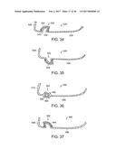 GOLF CLUB HEAD WITH STIFFENING MEMBER diagram and image