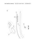 ELECTRONIC EYEGLASSES AND METHODS OF MANUFACTURING diagram and image