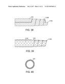 EXPANDABLE ACCESS SYSTEMS AND METHODS diagram and image