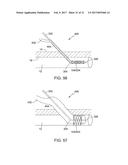 EXPANDABLE ACCESS SYSTEMS AND METHODS diagram and image