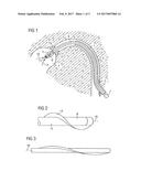 FLUID PUMP HAVING A RADIALLY COMPRESSIBLE ROTOR diagram and image