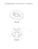 Anti-Theft Ring Assembly and Method of Using the Same diagram and image