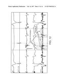 ELECTROANATOMICAL MAPPING diagram and image