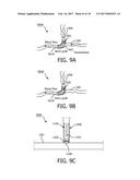 SYSTEM FOR PERFORMING INTRALUMINAL CORONARY AND METHOD OF OPERATION     THEREOF diagram and image