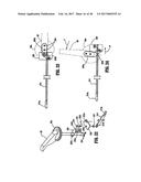 SURGICAL STAPLING DEVICE WITH INDEPENDENT TIP ROTATION diagram and image