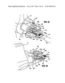 SURGICAL STAPLING DEVICE WITH INDEPENDENT TIP ROTATION diagram and image