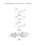 MAGNETIC COMPRESSION ANASTOMOSIS DEVICE diagram and image