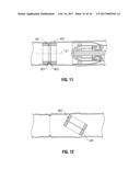 MAGNETIC COMPRESSION ANASTOMOSIS DEVICE diagram and image