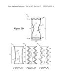 IMPLANTABLE DAMPING DEVICES FOR TREATING DEMENTIA AND ASSOCIATED SYSTEMS     AND METHODS OF USE diagram and image