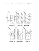 IMPLANTABLE DAMPING DEVICES FOR TREATING DEMENTIA AND ASSOCIATED SYSTEMS     AND METHODS OF USE diagram and image