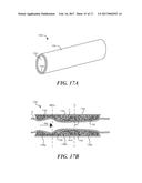 IMPLANTABLE DAMPING DEVICES FOR TREATING DEMENTIA AND ASSOCIATED SYSTEMS     AND METHODS OF USE diagram and image