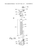 IMPLANTS FOR SECURING SPINAL FIXATION ELEMENTS diagram and image