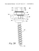 IMPLANTS FOR SECURING SPINAL FIXATION ELEMENTS diagram and image