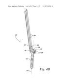 IMPLANTS FOR SECURING SPINAL FIXATION ELEMENTS diagram and image