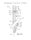 IMPLANTS FOR SECURING SPINAL FIXATION ELEMENTS diagram and image