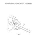 METHODS AND INSTRUMENTS FOR USE IN VERTEBRAL TREATMENT diagram and image