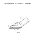 METHODS AND INSTRUMENTS FOR USE IN VERTEBRAL TREATMENT diagram and image