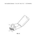 METHODS AND INSTRUMENTS FOR USE IN VERTEBRAL TREATMENT diagram and image