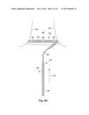 SYSTEMS AND METHODS FOR MAKING AND USING MEDICAL ABLATION SYSTEMS HAVING     MAPPING CATHETERS WITH IMPROVED ANCHORING ABILITY diagram and image