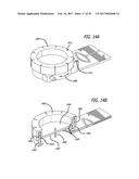 DEVICES AND METHODS FOR PERFORMING SUBCUTANEOUS SURGERY diagram and image