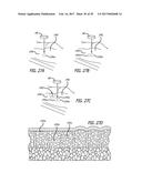 DEVICES AND METHODS FOR PERFORMING SUBCUTANEOUS SURGERY diagram and image